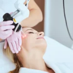 A woman undergoing fractional CO2 laser treatment on her face in a clinical setting.