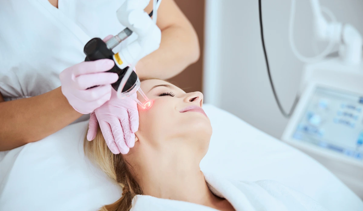 A woman undergoing fractional CO2 laser treatment on her face in a clinical setting.